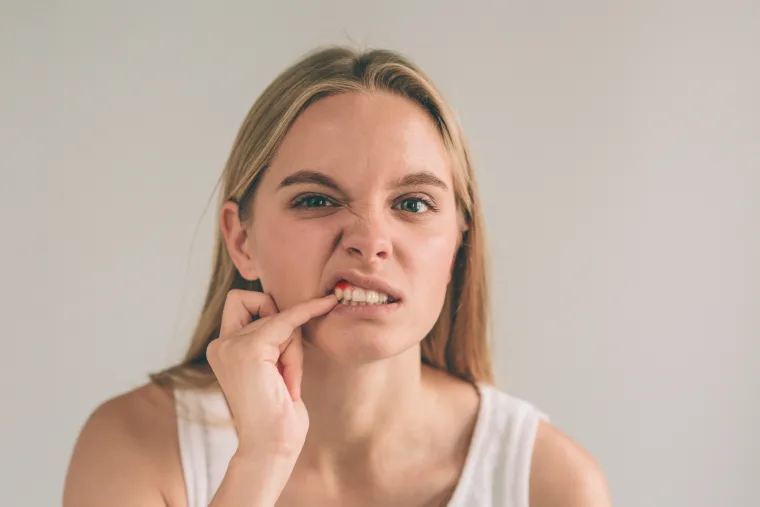 2. Krvarenje desni - Brojna su istraživanja pokazala da su ljudi s niskom razinom vitamina C u organizmu podložniji riziku od krvarenja desni. Svakako posjetite stomatologa, ali i povećajte unos namirnica bogatih vitaminom C. 
