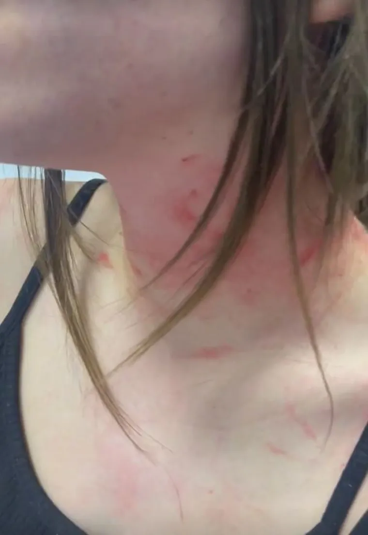Strava u obitelji poznate Srpkinje, objavila jezive prizore: 'Pretukao mi je sestru skoro namrtvo...'