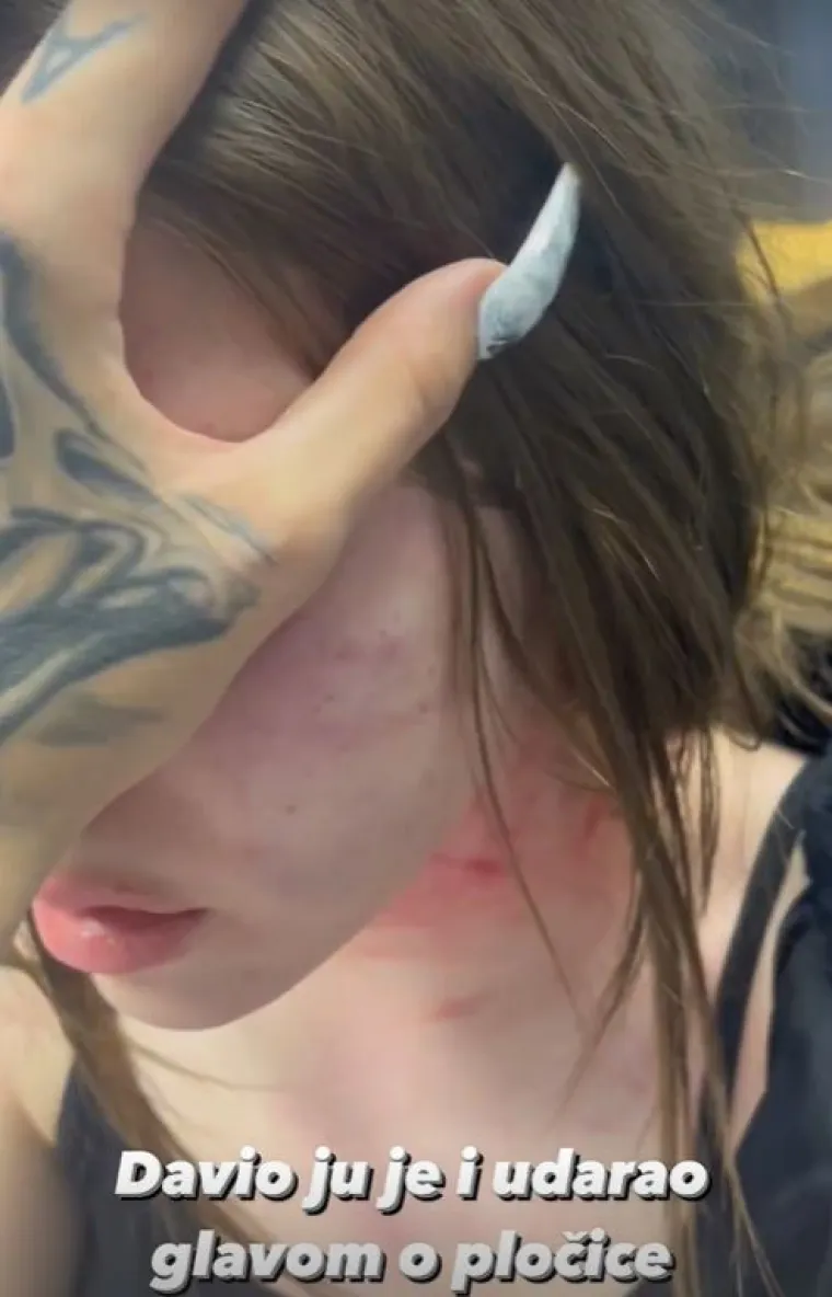&quot;Nakon što ju je večeras unakazio, dovezao ju je na VMA i pobjegao dok mu nisu došli tata i brat jer je tatin sin. Došli su smijući nam se pred policijom uz dobacivanja s očeve strane kako je ponosan na svog sina i kako će tek biti&quot;, napisala je.