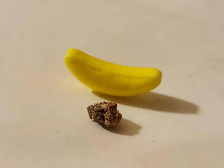 Objavio je i fotografiju svog kamenca, a kao usporedbu, donekle šaljivo stavio je bananu. &quot;Hvala bogu, nije prava banana&quot;, odgovorio je na pitanje nego je posrijedi bombon u obliku banane. Kamenac je velik, ali i dalje ni do koljena bolnim rekorderima. 