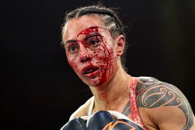 Boksački 'masakr' u teniskom hramu: U&scaron;le su u ring i pomlatile se za ne povjerovati; 'Ovo posvećujem svom bratu, bio je sa mnom u kutu'