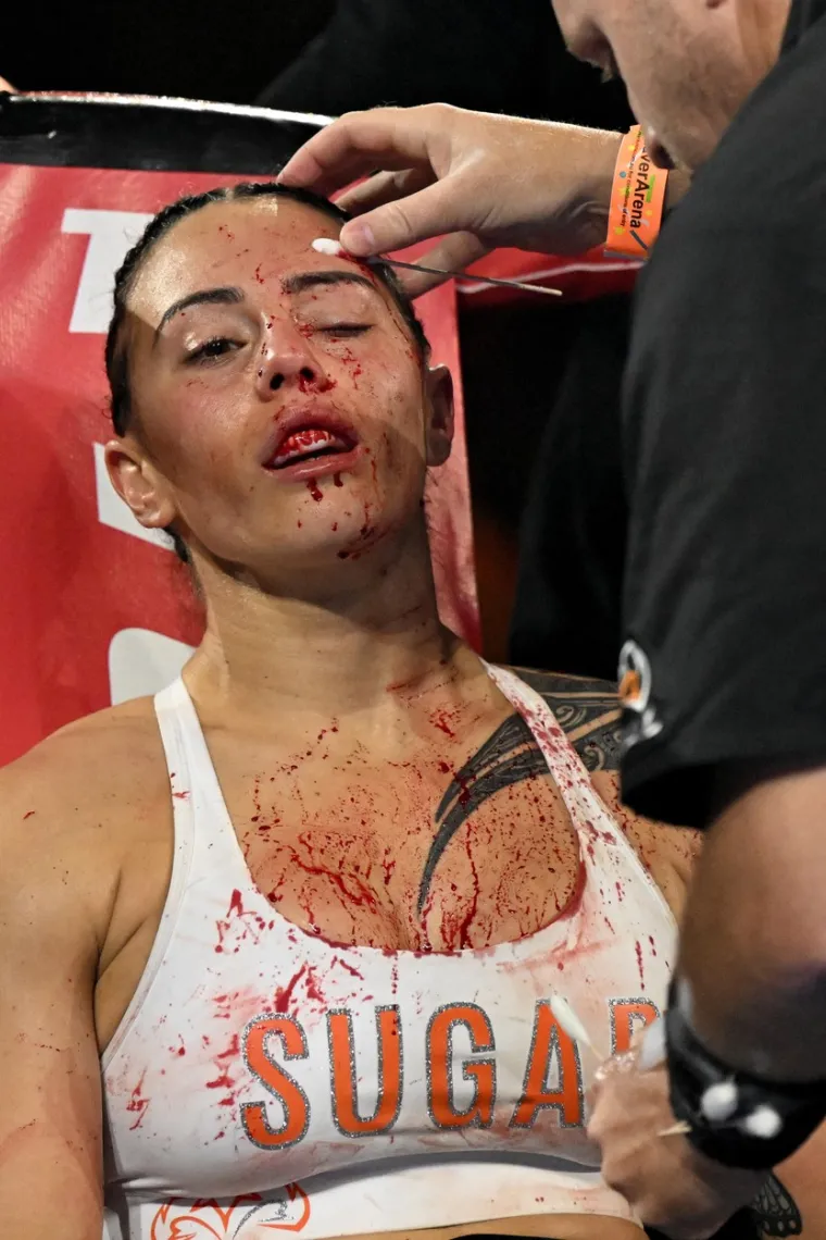 Boksačice u okršaju za svjetsku titulu pružile rijetko brutalnu borbu, krv je liptala na sve strane