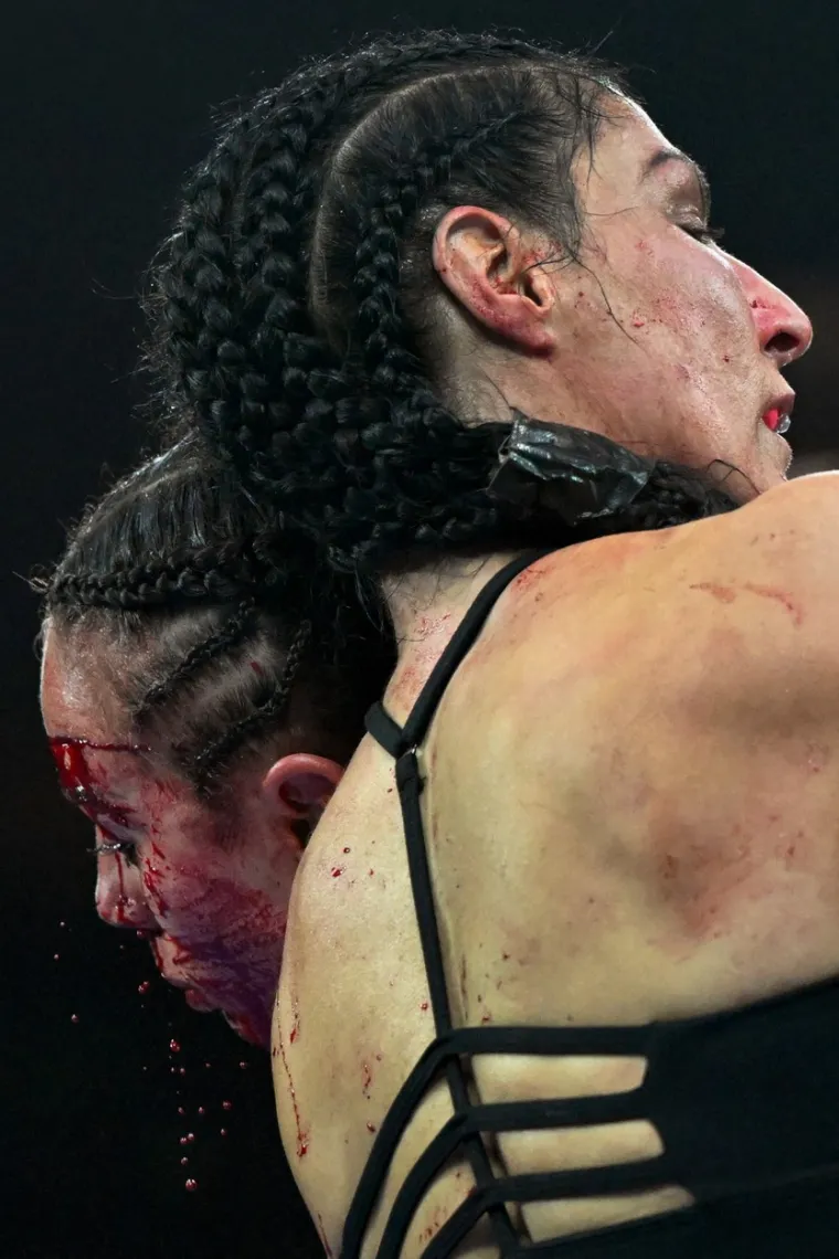 Boksačice u okr&scaron;aju za svjetsku titulu pružile rijetko brutalnu borbu, krv je liptala na sve strane