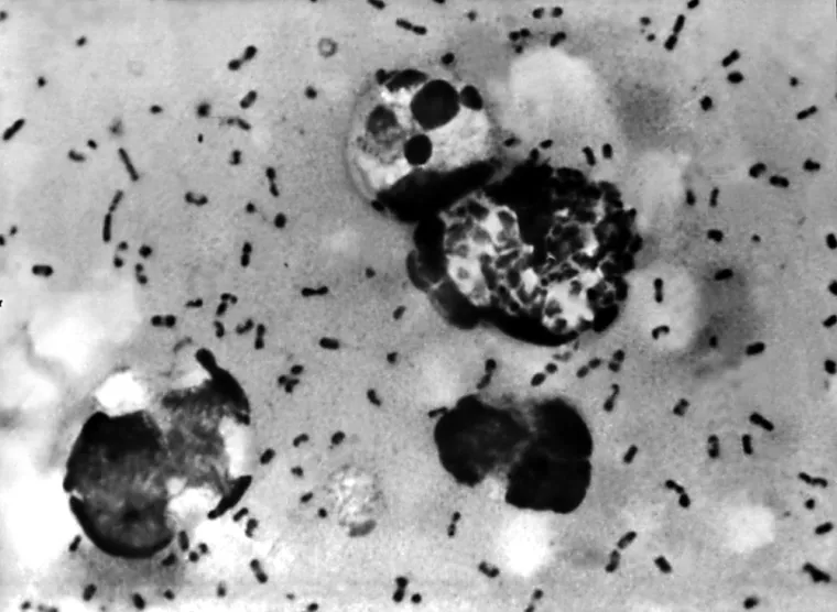 Uzrokovana bakterijom Yersinia pestis, Crna smrt bila je kataklizmička pandemija bubonske kuge koja je opustošila zapadnu Euroaziju i sjevernu Afriku između 1346.-52. pr. Kr. Umrle su stotine milijuna ljudi, najviše u Europi gdje je možda nestalo i do 50 posto stanovništva.