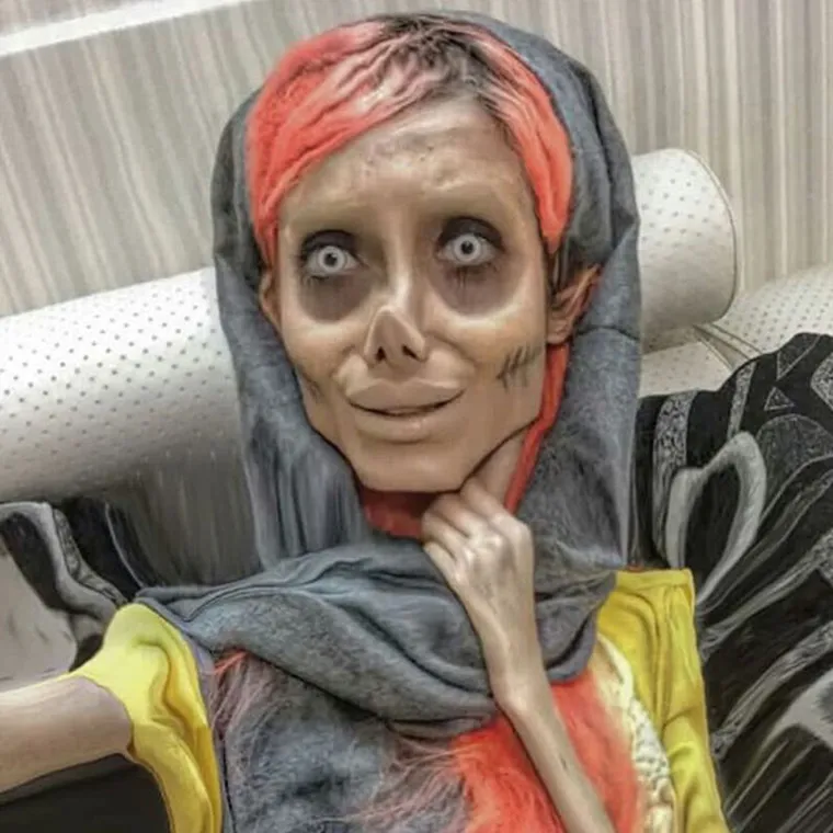 Tada 17-godišnja Iranka Tabar, tvrdila je da je operirala svoje lice kako bi izgledala isto kao Angelina Jolie. 