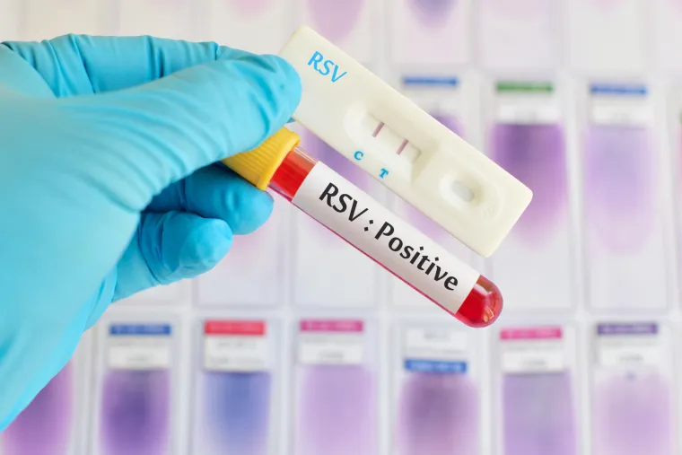 Infekcije RSV-om porasle su za 8,3 posto u tjednu koji je završio 30. listopada, s najvišim stopama u dobi ispod pet godina od 29,3 posto. Podaci UKHSA-e također pokazuju da su se povećali i posjeti urgentnoj medicini za bronhiolitis (infekcija koju obično uzrokuje RSV) kod djece mlađe od jedne godine. Također, porastao je i broj hospitalizacija zbog RSV-a u dobi ispod pet godina. Osim toga, broj oboljelih od gripe raste, dok se čini da broj zaraženih Covidom-19 opada.