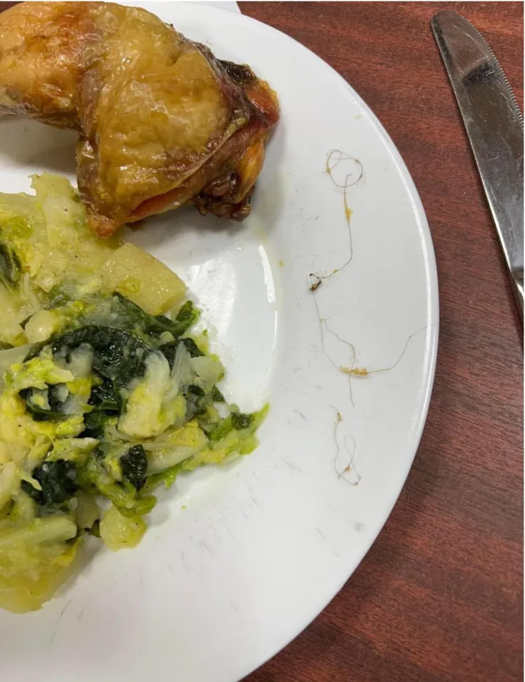 Jela u menzi često sadržavaju i vlasi kose, a onda se pojedinci znaju naći i reći &quot;Mogao ju je student/studentica sama ubaciti.&quot;

Pričali smo sa studentom koji je objavio fotografiju na kojoj je vidljiva vlas kose te nam je opisao cjelokupnu situaciju.

&quot;Dlake koje se nalaze na slici s desne strane su se prethodno nalazile u pilećem bataku - izvukao sam ih iz bataka i stavio sa strane čisto kako bi se lakše mogao steći opseg problema. Dakle, dlake nisu pronađene u svežnju ili su manipulacijom stavljene na tanjur&quot;, poručio je.

To je isto slučaj iz menze u Studentskom domu Stjepan Radić, a kaže da tete nije upozorio iz razloga jer se uvijek može pretpostaviti kakav bi bio odgovor da je prijavio problem.