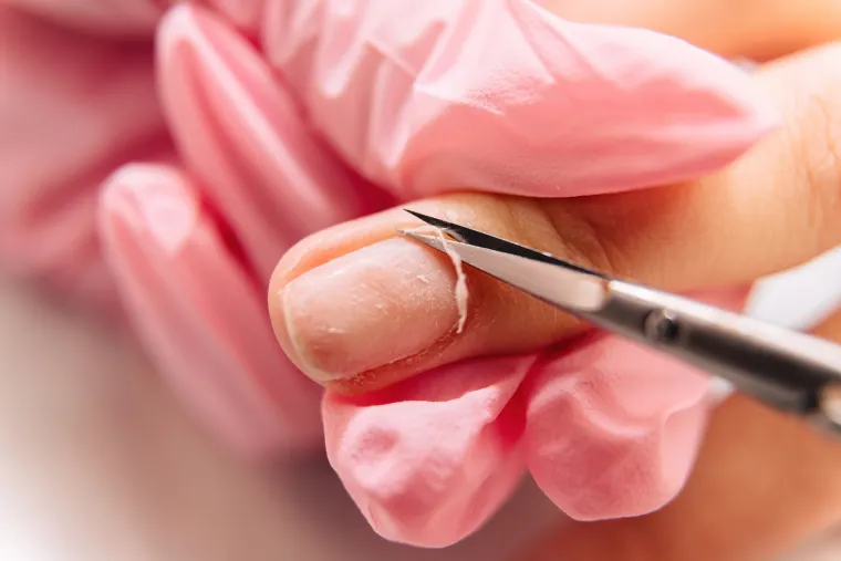 13. Režu vam zanoktice: Dermatolozi ne preporučuju rezanje zanoktica jer to može dovesti do infekcije i iritacije. Umjesto rezanja zanoktica, tehničar bi trebao koristiti sredstvo za uklanjanje zanoktica kako bi ih omekšao, a zatim ih nježno gurnuti natrag. 