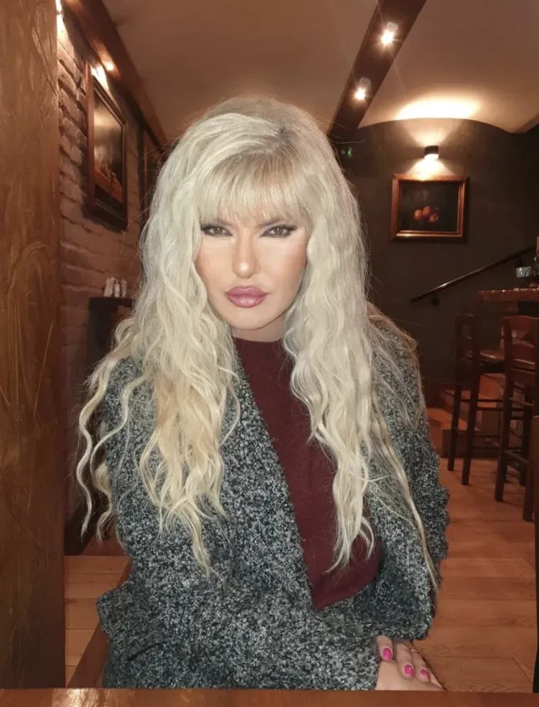 Mama Jasna i kći Lea Milenković nakon silnih korekcija liče kao jaje jajetu, ali pr&scaron;te od ponosa: 'Moje lice je dokaz da Bog postoji'