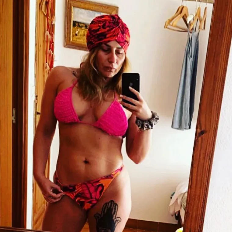 Izvan epizoda bolesti, koje mogu trajati i godinama, osoba ne mora imati simptome bolesti ili oni mogu biti blagi do umjereni. Tek kod manjeg broja oboljelih, simptomi mogu biti stalno prisutni i otežavati svakodnevni život, osobito kada se ne provod adekvatno liječenje.