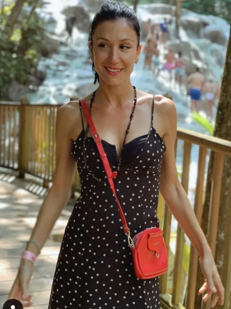 Sa 16 godina pala je ispred kuće i razbila nos, što je rezultiralo kvrgom koju je odlučila estetski korigirati.
