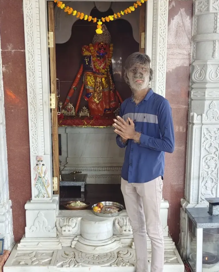 Nasilnici bi ga čak gađali kamenjem kao da je čudovi&scaron;te iz starog horor filma.