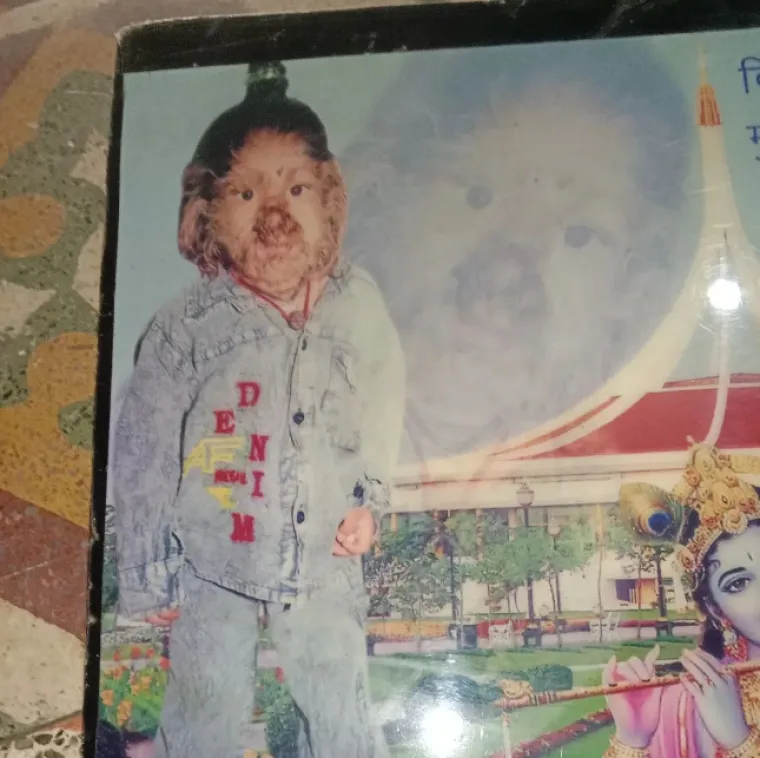 Srećom, Patidar je od tada naučio prihvatiti svoje jedinstveno lice i ne dopustiti da ga spriječi da vodi sretan i ispunjen život.