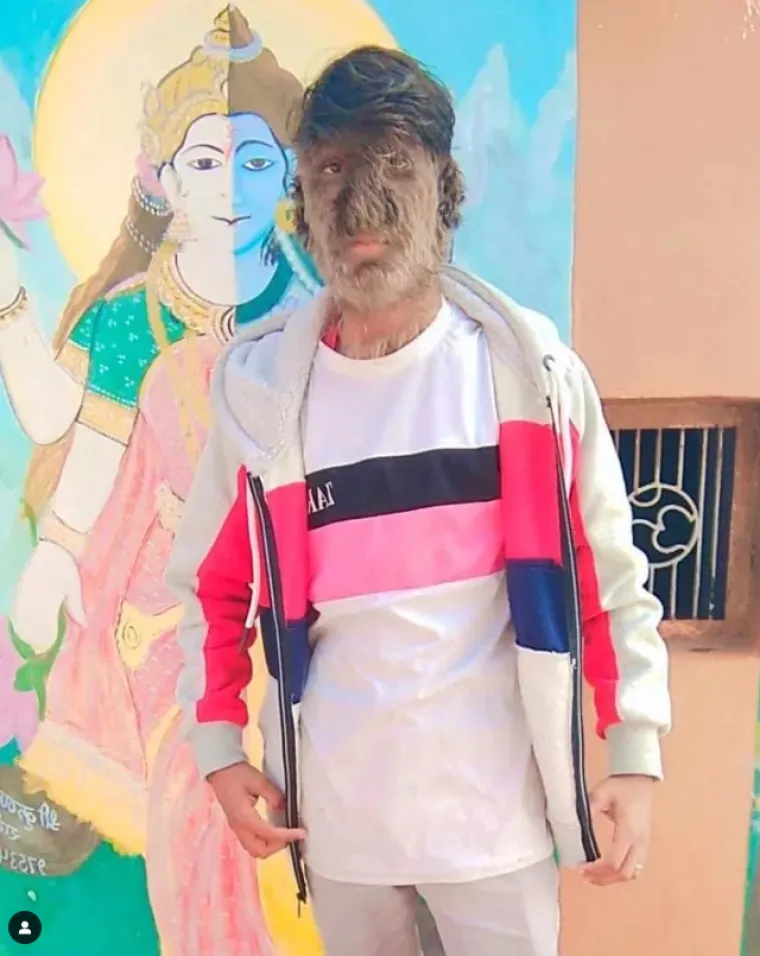 U konačnici, smatra da fizički izgled ne bi trebao spriječiti nekoga da slijedi svoje snove.