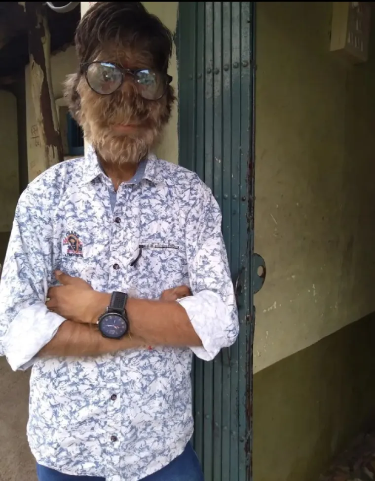 "Morao sam naučiti mnogo stvari tijekom svog putovanja, najvažnije od svega sam naučio da sam jedan od milijun", rekao je tinejdžer. "Nikada ne bih trebao odustati živjeti život punim plućima. Uvijek želim ići naprijed i biti sretan."