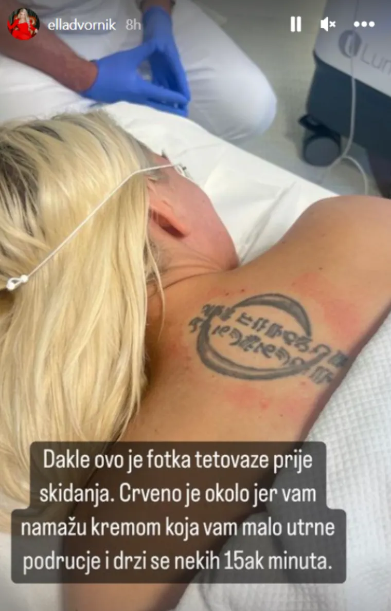 &quot;Dakle, ovo je tetovaža prije skidanja. Crveno je okolo jer vam namažu kremom koja vam malo utrne područje i drži se nekih 15-ak minuta... Bol je 10/10, neću vam lagati pa da me tamo psujete kada budete skidali. Ovo je fotografija od danas ujutro. Kao što možete vidjeti, jako puno je otišlo jednim tretmanom tako da je vrijedilo boli&quot;, zaključila je Ella.