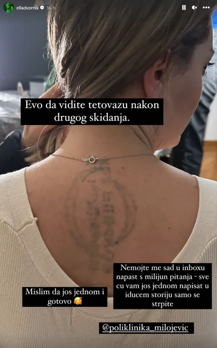 Ella je odlučila ukloniti tetovažu jer je &quot;ružna ko smrt&quot;. Sad je objavila kako tetovaža izgleda nakon nekog vremena. &quot;Evo da vidite tetovažu nakon drugog skidanja. Mislim da još jednom i gotovo&quot;, objasnila je. 