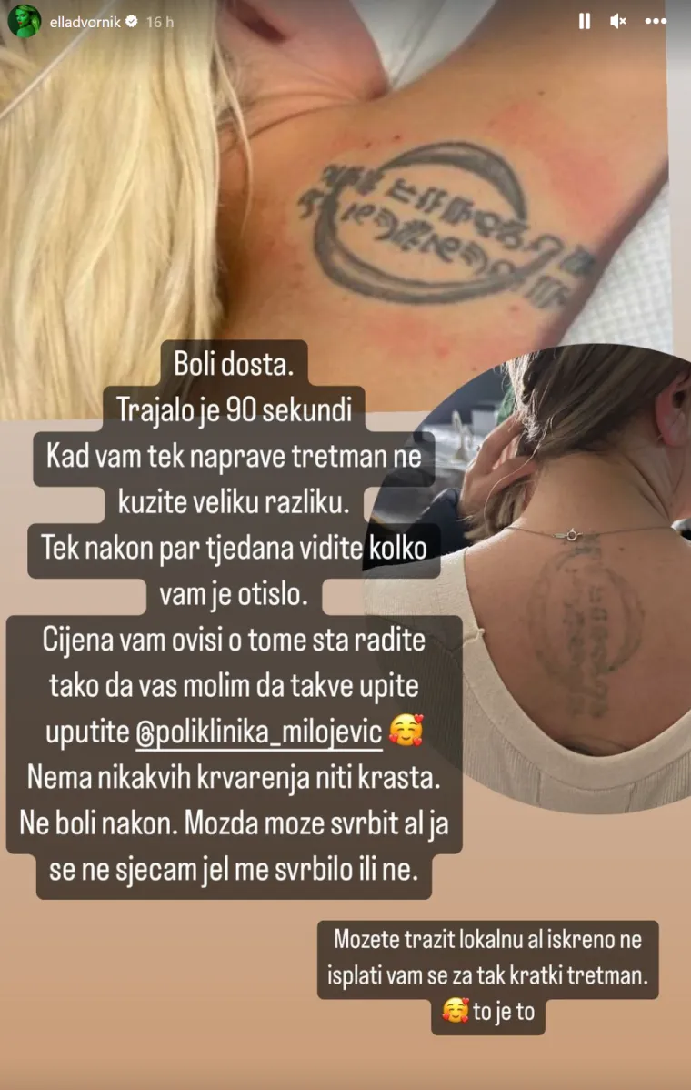 &quot;Dosta boli. Trajalo je 90 sekundi. Kad vam tek naprave tretman, ne kužite veliku razliku. Tek nakon nekoliko tjedana vidite koliko vam je tetovaže &apos;otišlo&apos;. Cijena ovisi o tome što radite. Nema nikakvih krvarenja ni krasta. Ne boli nakon. Možda može svrbiti, ali ja se ne sjećam je li me svrbjelo ili ne. Možete tražiti i lokalnu anesteziju, ali iskreno ne isplati vam se za tako kratki termin&quot;, objasnila je Ella.