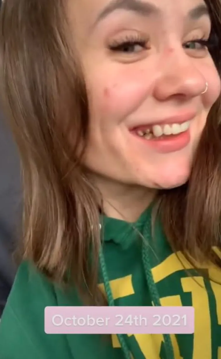 &quot;Kad je počelo oštećenje živaca i kad sam dobila protezu za gornje desni, bilo je gadno. U redu je plakati, ovo nije lako&quot;, rekla je tužno.