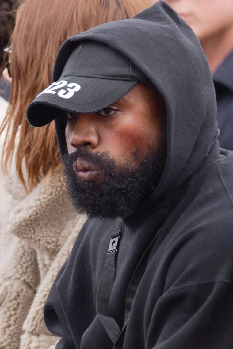Bilo je to sada već davne 2002. godine kada je glazbenik Kanye West doživio tešku prometnu nesreću. West je zaspao za volanom u vožnji, i to oko tri ujutro. Sa svojim Lexusom potom se zabio u auto koji je dolazio iz suprotnog smjera, a u nesreći mu je čeljust bila potpuno smrskana, dok je njegov suvozač zadobio prijelom obje noge. West je završio na teškoj operaciji i ugrađena mu je metalna ploča u bradu, a usta su mu bila zatvorena više od mjesec dana.