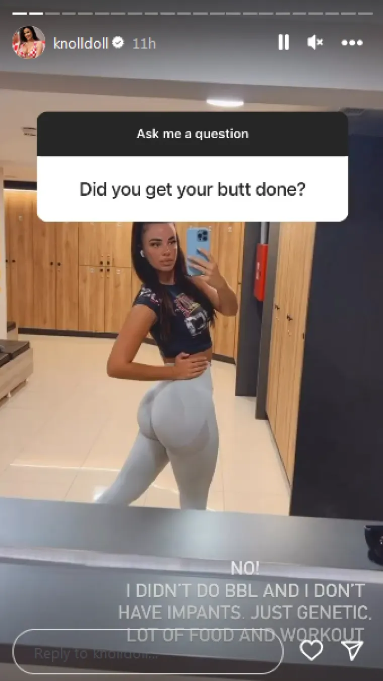 Mnogi već duže vrijeme tvrde kako Ivanina stražnjica nije prirodna, stoga ne čudi da se među svima na&scaron;lo i to pitanje. "Ne, nisam radila podizanje stražnjice niti sam stavila implantate. Samo genetika, puno hrane i vježba", odgovorila je Ivana i napokon rije&scaron;ila misterij.