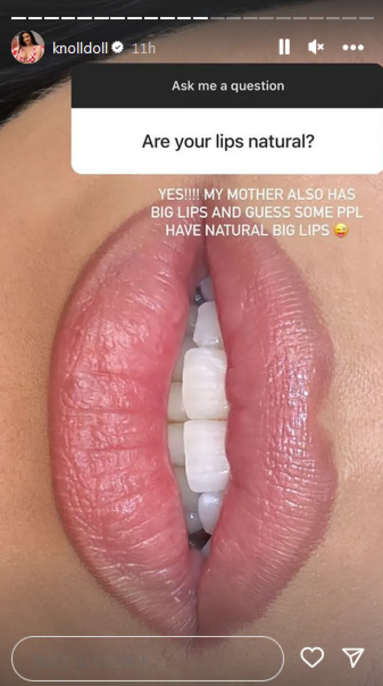 Kada su Ivanu pratitelji upitali jesu li joj usne prave, ona je kratko odgovorila: "Da! Moja mama također ima velike usne. Čini se da neki ljudi ipak imaju prirodno velike usne."