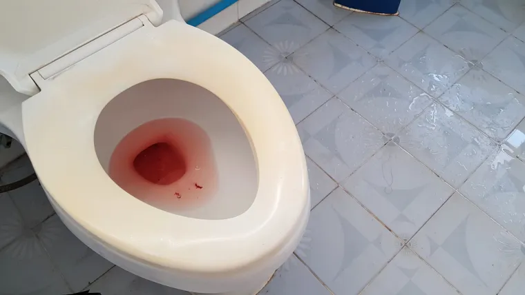 5. krv u urinu