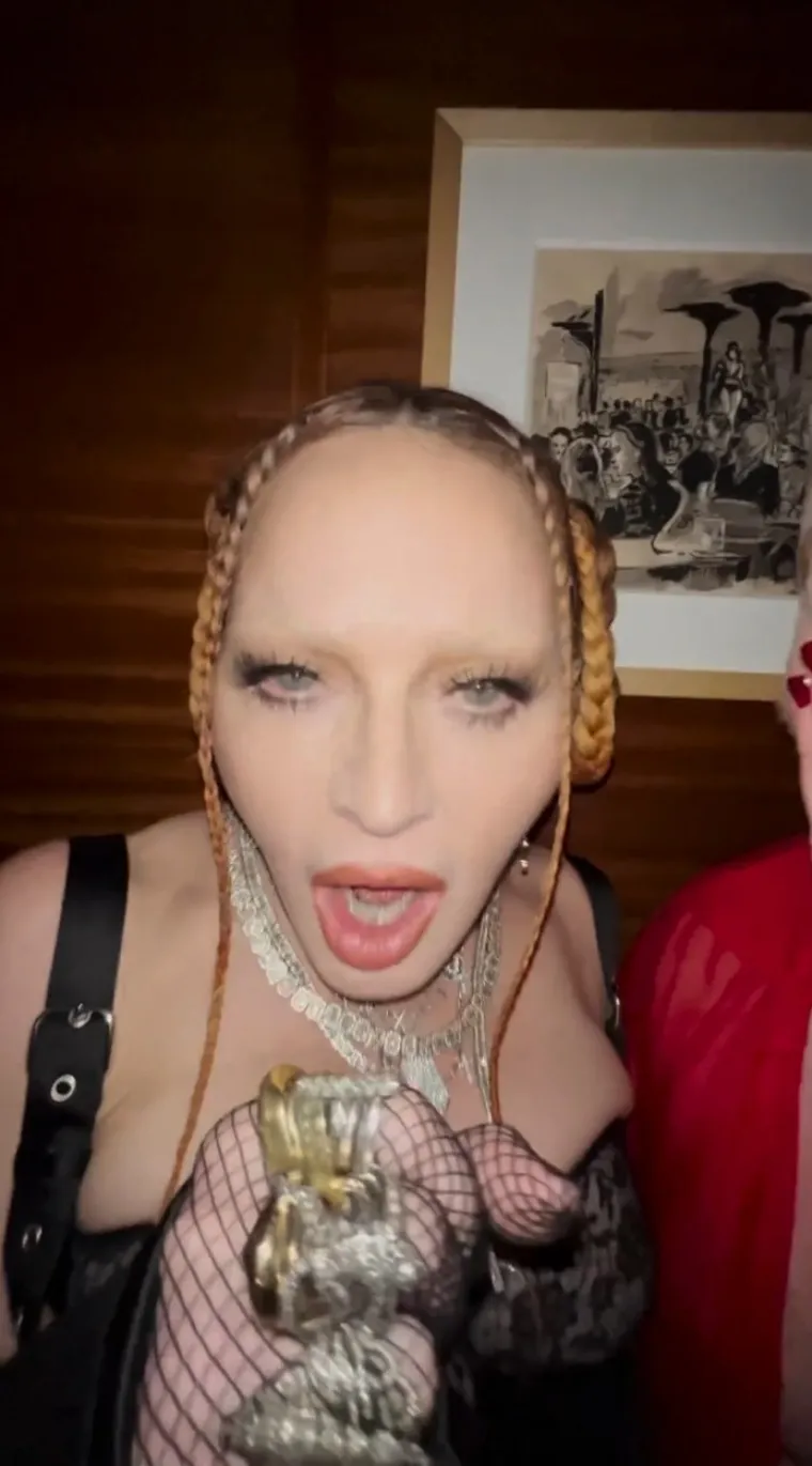 "Madonna mora prestati s plastičnim operacijama i prihvatiti proces starenja. Gotovo je neprepoznatljiva u ovom trenutku", "Bože moj, &scaron;to si je to učinila?", "Je li Madonna nominirana za novo lice godine?" neki su od brojnih komentara na dru&scaron;tvenim mrežama.