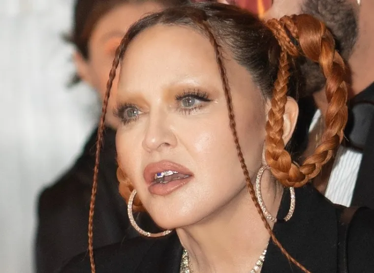 "Nikada se ne bih podvrgnula estetskoj operaciji. Gadi mi se i sama pomisao da vas netko uspava, a zatim napadne nožem kako bi vas uljep&scaron;ao. Svoju pojavu dugujem genima i zdravom načinu života", slatkorječivo je do prije tri godine govorila Madonna, no situacije se itekako promijenila...