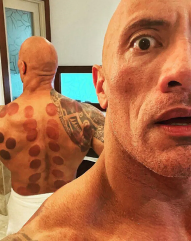 The Rock je 2021. prvi put isprobao terapiju i rekao: “Uživao sam u terapiji. Uvijek tražim nove tehnike kako bih održao ovo 250 milijuna godina staro tijelo dinosaura uravnoteženim i optimalnim ne samo sa svim mojim prošlim ozljedama, već i sa svojim svakodnevnim brušenjem. Sve to uzima svoj danak, stoga je ključno biti proaktivan. Imamo samo jedno tijelo, pa se moramo pobrinuti za njega.”