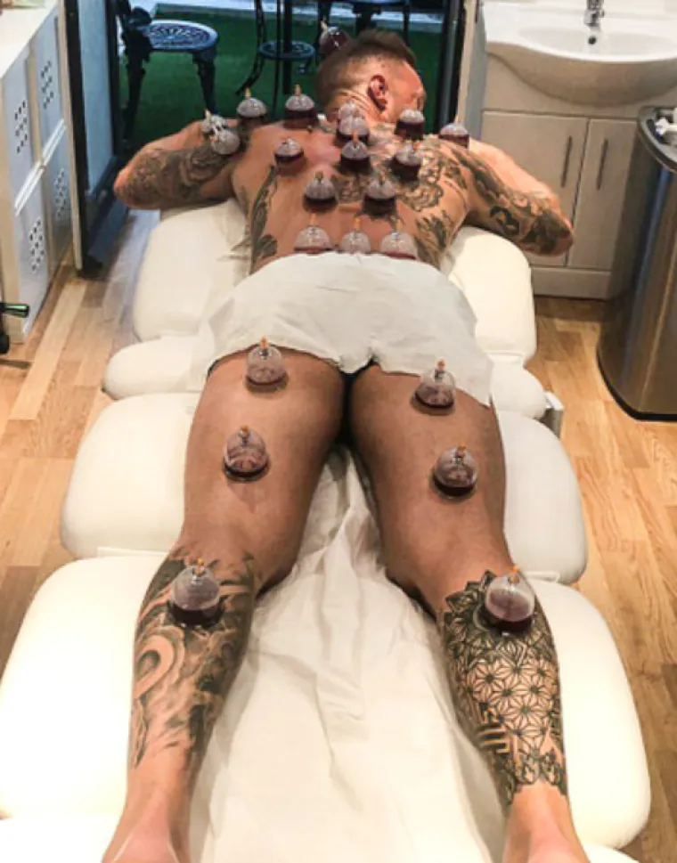 Calum Best, britansko-američko TV lice, kaže da se nikada nije osjećao bolje. “Tako je hardcore, ali otišao sam osjećajući se 10 puta lakšim, osvježenim i s čišćim sustavom. Vratio sam se 2 mjeseca kasnije da to ponovim i izašlo je 10 puta manje krvi, što pokazuje da mi se krvožilni sustav pročistio. U čašicu dolazi ustajala, nezdrava krv, a kako nema zraka, odmah se zgruša.”