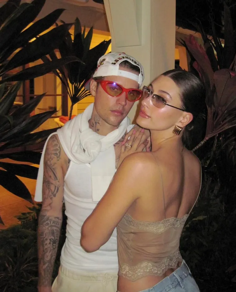 Hailey Bieber ispričala je sve o svojoj ljubavi prema prirodnim lijekovima za zdravlje. “Kunem se u kiropraktiku, kunem se u akupunkturu. Volim ići u saune, infracrvene saune, volim sve to.” Čini se da Justin Bieber također koristi cupping terapiju i otvoren je za poziranje za snimanja časopisa i fotografiranje nakon tretmana.