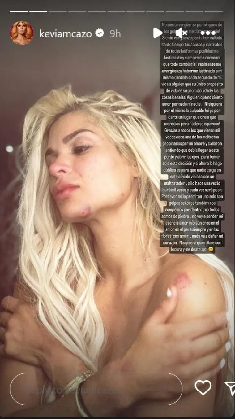 Uhvatila je poznatog nogometa&scaron;a u krevetu s dvije prostitutke, pa onda od njega dobila gadne batine? 'Bila je pijana i ljuta...'