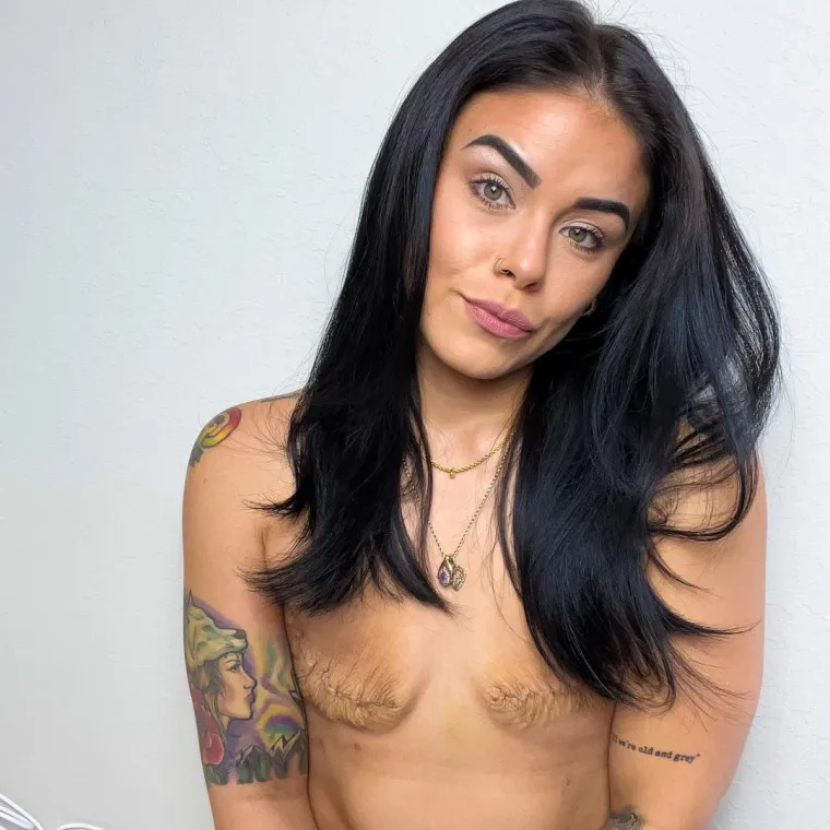 &quot;Znala sam da ne želim riskirati s rakom dojke, pa sam željela mastektomiju. Trebao mi je samo jedan razgovor sa zaručnicom da pomislim kako ću izgledati fantastično ako budem ravna jer postoji manje rizika ako ne stavim implantate&quot;, otkrila je.