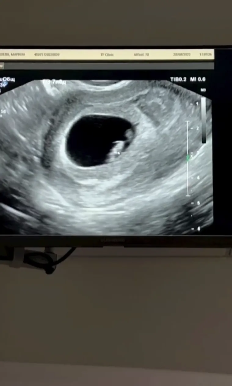 Marina (37) je bila maćeha Vladimiru (23), a sada čekaju drugo dijete: 'Seksala se s mojim sinom dok sam bio u kući...'