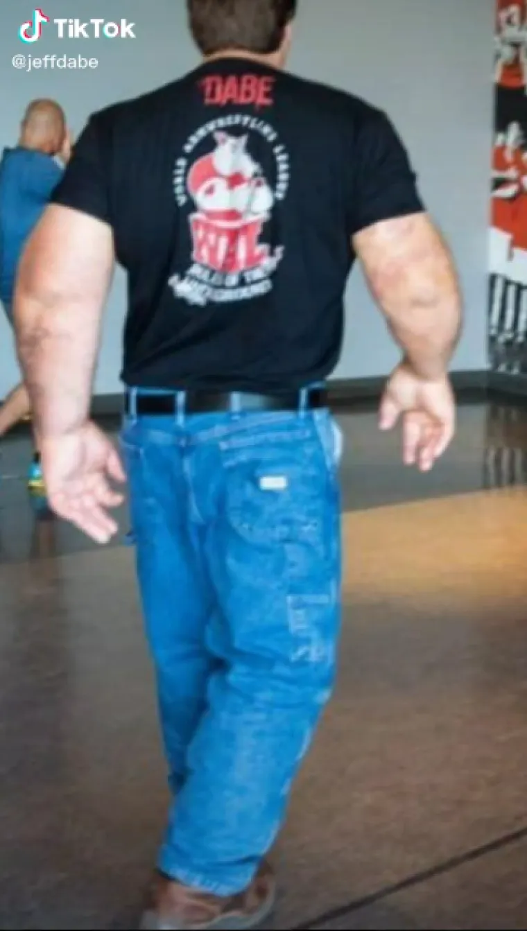 Drugi su Jeffa pitali je li mu ikada bilo što dijagnosticirano, a Jeff je rekao da ga je njegova obitelj vodila liječnicima kad je imao šest godina. Rekao je da je &quot;nekoliko liječnika stajalo uokolo bockajući ga&quot; i da je od tada testiran na gigantizam i elefantijazu - ali nije pronađeno nikakvo medicinsko objašnjenje za njegove velike ruke.