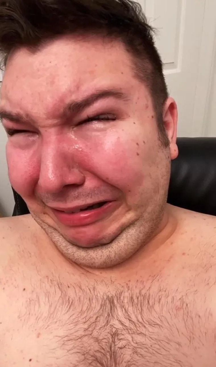 &ldquo;Ne mogu zaspati jer se osjećam kao da mi probavni trakt gori pa onda trčim u kupaonicu, sjedim na WC-u i plačem&rdquo;, objasnio je.