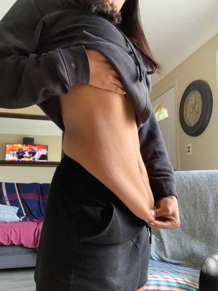 Do svoje 18. težila je 111 kg: Doktori nisu imali lijepe prognoze, a onda je prelomila i - sada izgleda wow!