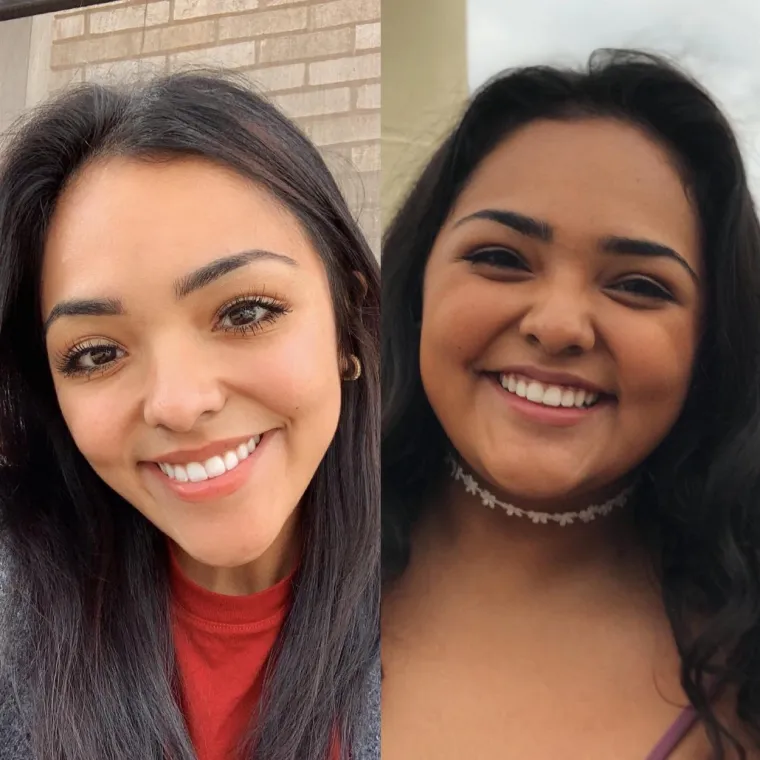 Do svoje 18. težila je 111 kg: Doktori nisu imali lijepe prognoze, a onda je prelomila i - sada izgleda wow!