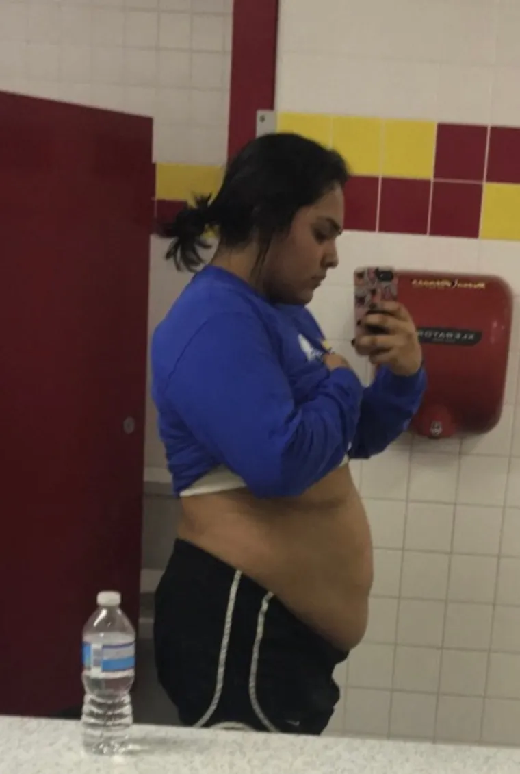 Do svoje 18. težila je 111 kg: Doktori nisu imali lijepe prognoze, a onda je prelomila i - sada izgleda wow!