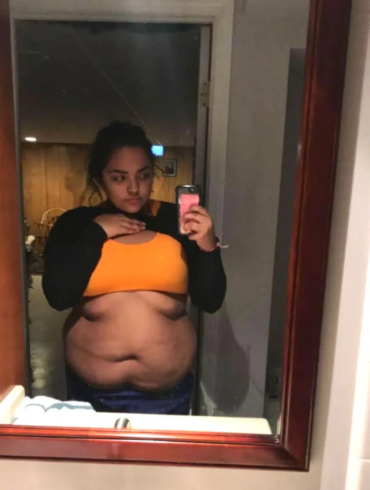 Do svoje 18. težila je 111 kg: Doktori nisu imali lijepe prognoze, a onda je prelomila i - sada izgleda wow!