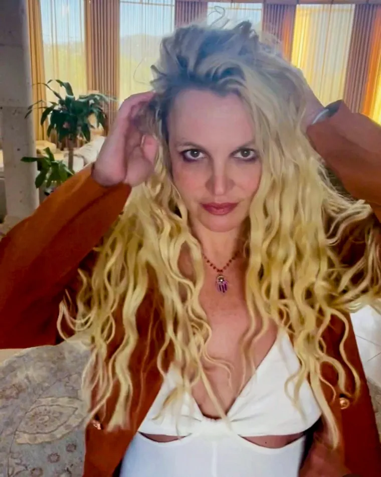 Britney Spears, kao i njena kolegica Christina Aguilera, ima trakcijsku alopeciju. Korijen dlake uništile su joj godine blajhanja i zanemarivanja te ugradnja previše ekstenzija.