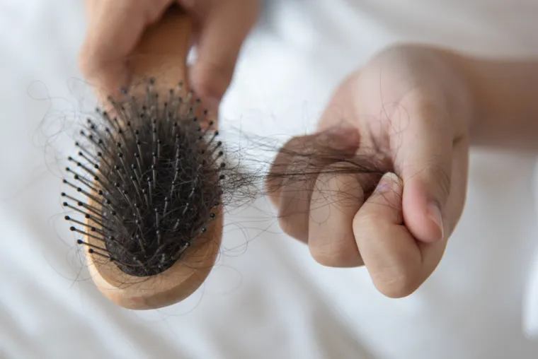 1. Višak kose na češlju: Estrogen, glavni ženski spolni hormon, igra važnu ulogu kada je u pitanju rast kose. U bilo kojem trenutku, oko 85 posto kose na našoj glavi trebalo bi biti u fazi rasta, za što su potrebne visoke razine estrogena, dok se 15 posto odmara, gubi ili se regenerira. Dakle, kada vaša razina estrogena padne, kao rezultat starenja, menopauze, prekomjerne tjelovježbe ili dijete, ili nekih autoimunih stanja, opada i vaša razina rasta dlake i više ulazi u fazu ispadanja. 