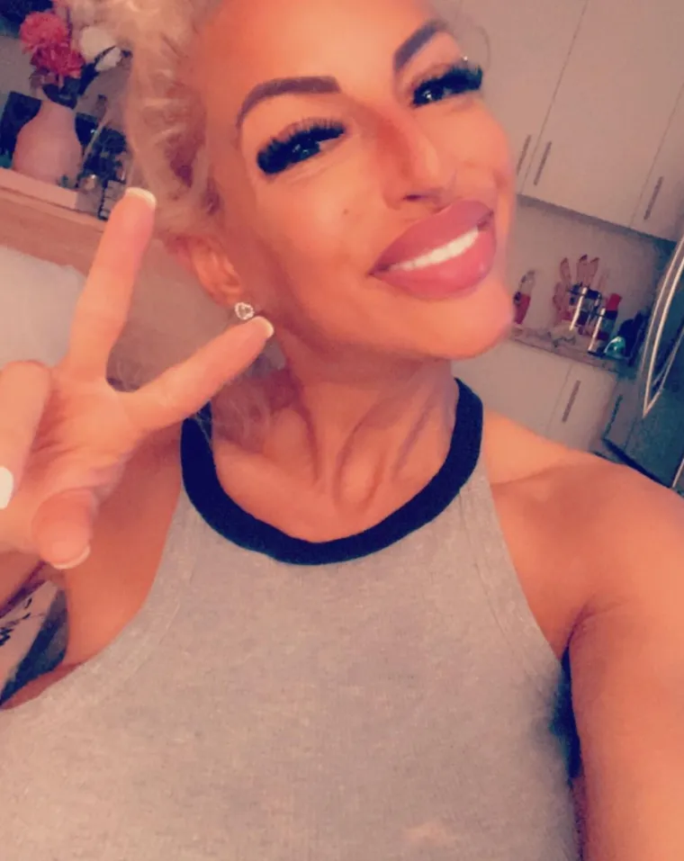 Drastično smr&scaron;avjela radi zdravlja, a onda dobila najgoru dijagnozu: 'Na sam Badnjak saznala sam da imam rak...'