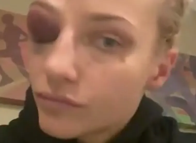 Najzgodnija boksačica dobila je nestvarnu lovu samo zato jer je otvorila Onlyfans: 'Oni dobro znaju kakva sam ja...'