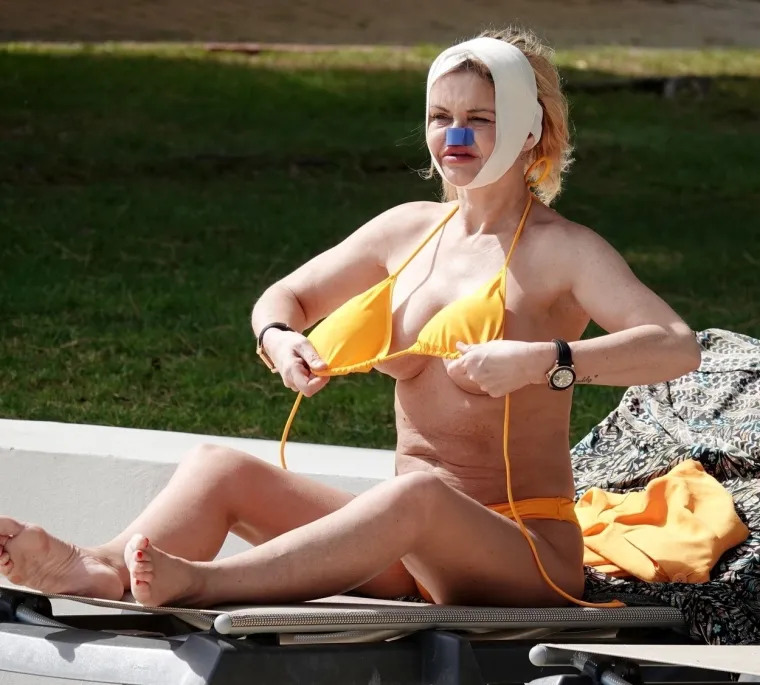 Bivša sudionica 'Big Brothera' zbog kokaina izgleda kao mumija: Trune joj lice, a nove fotke s bazena ozbiljno uznemiruju