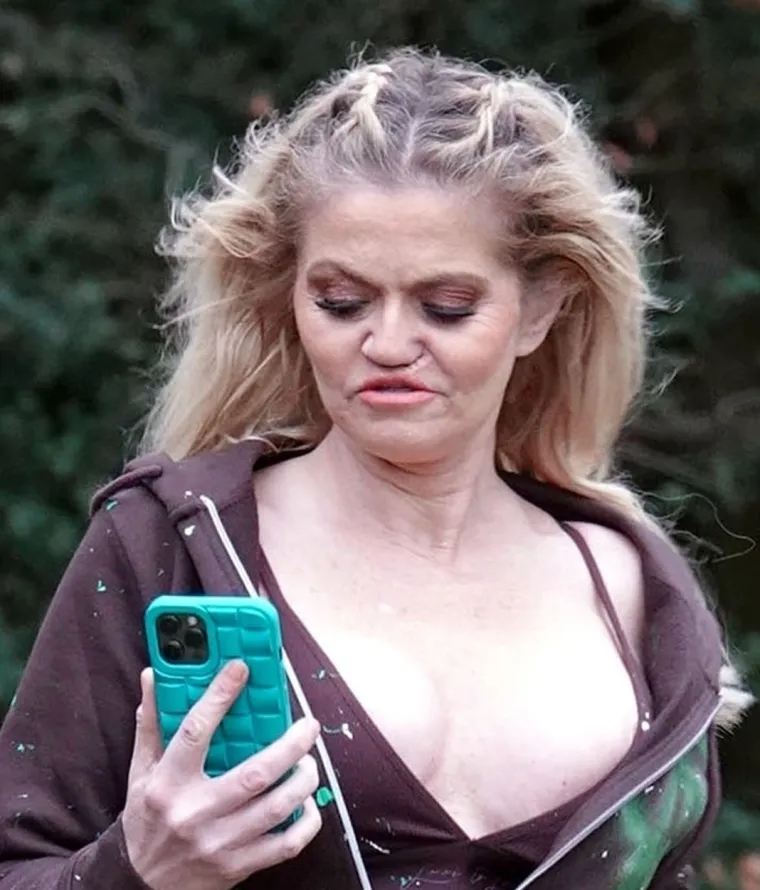 Bivša sudionica 'Big Brothera' zbog kokaina izgleda kao mumija: Trune joj lice, a nove fotke s bazena ozbiljno uznemiruju