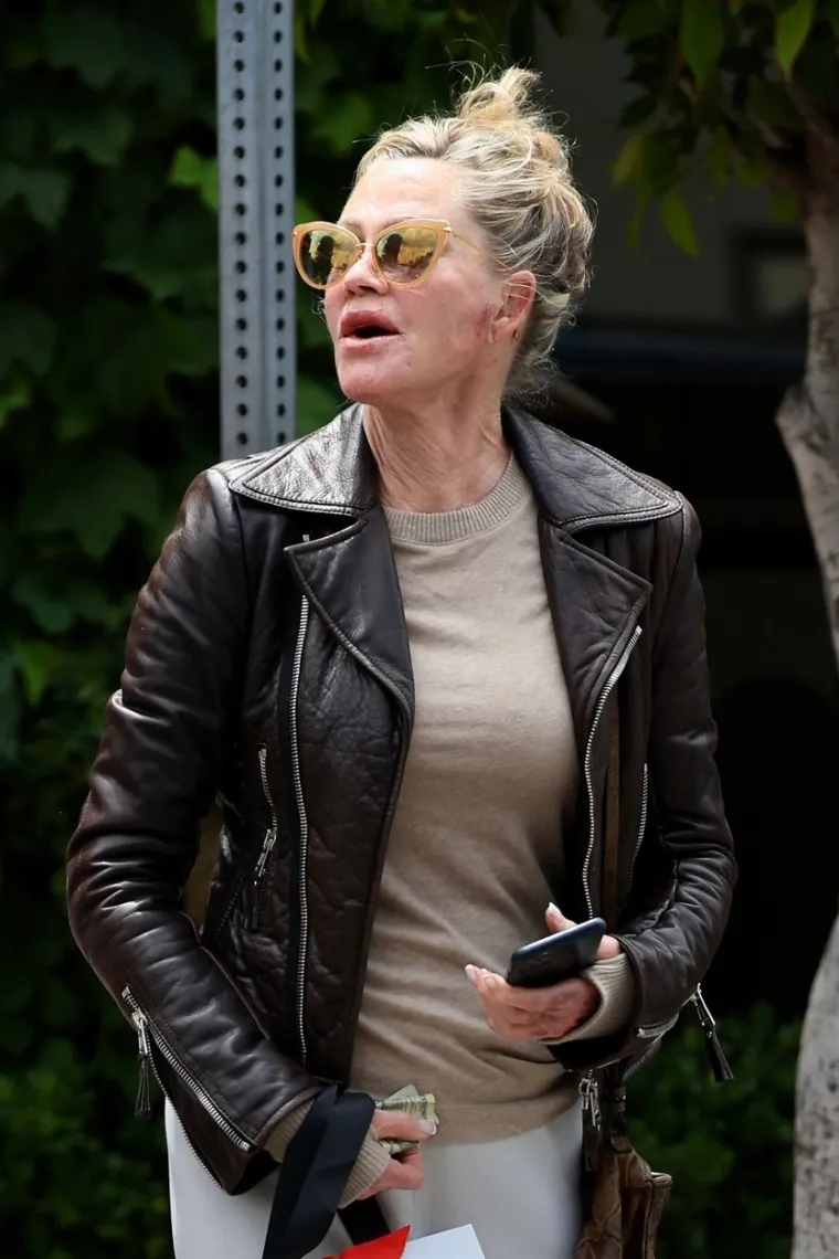Melanie Griffith zabrinula fanove pojaviv&scaron;i se s neobičnim ožiljcima na licu i rukama: Ovo je izdanje &scaron;okiralo svijet