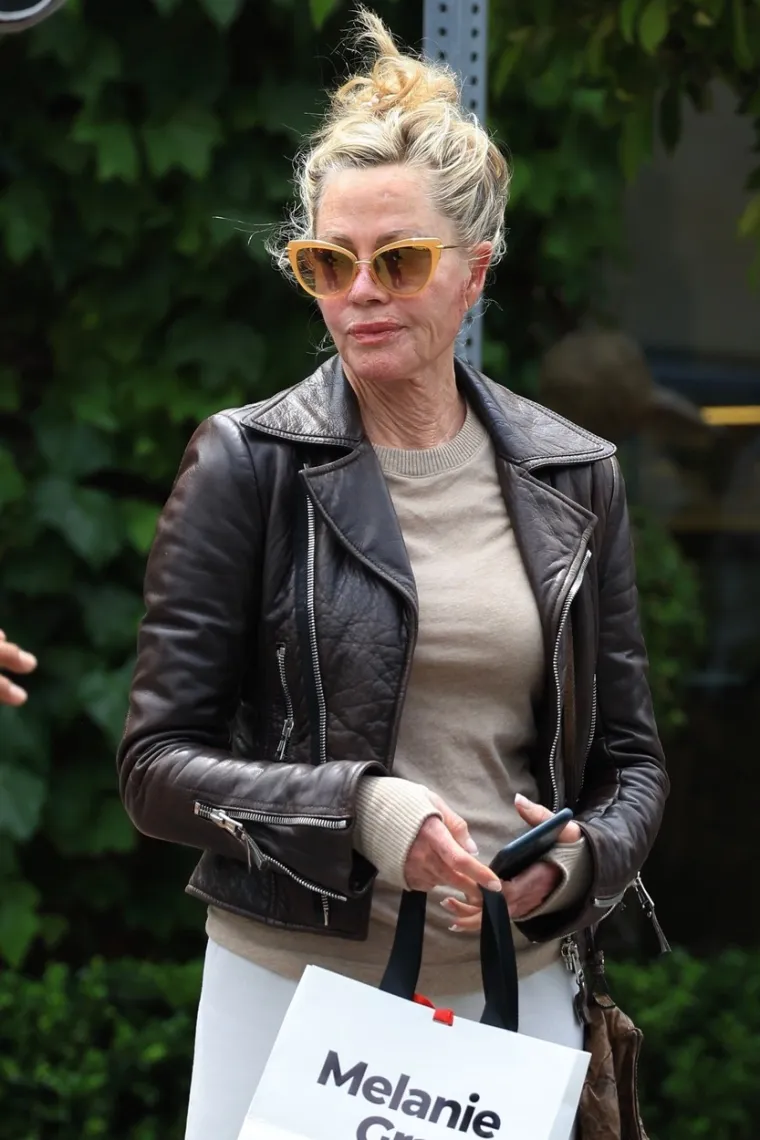Melanie Griffith zabrinula fanove pojaviv&scaron;i se s neobičnim ožiljcima na licu i rukama: Ovo je izdanje &scaron;okiralo svijet