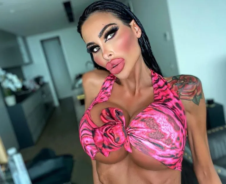 Danas je Instagram model, a svijet je za nju saznao zbog popularne emisije na E! kanalu &quot;Botched&quot;, u kojoj je sudjelovlala s ciljem da joj tim poznatih plastičnih kirurga ugradi još veće silikone u grudi.